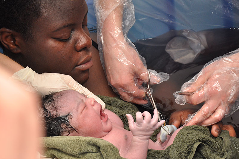 Picture of woman holding baby in birth pool. Two gloved hands are clamping the baby’s umbilical cord.